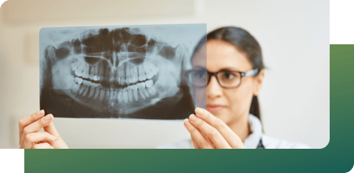 X-ray image showing the alignment and position of the jaw and teeth, helping determine if wisdom tooth removal is necessary.