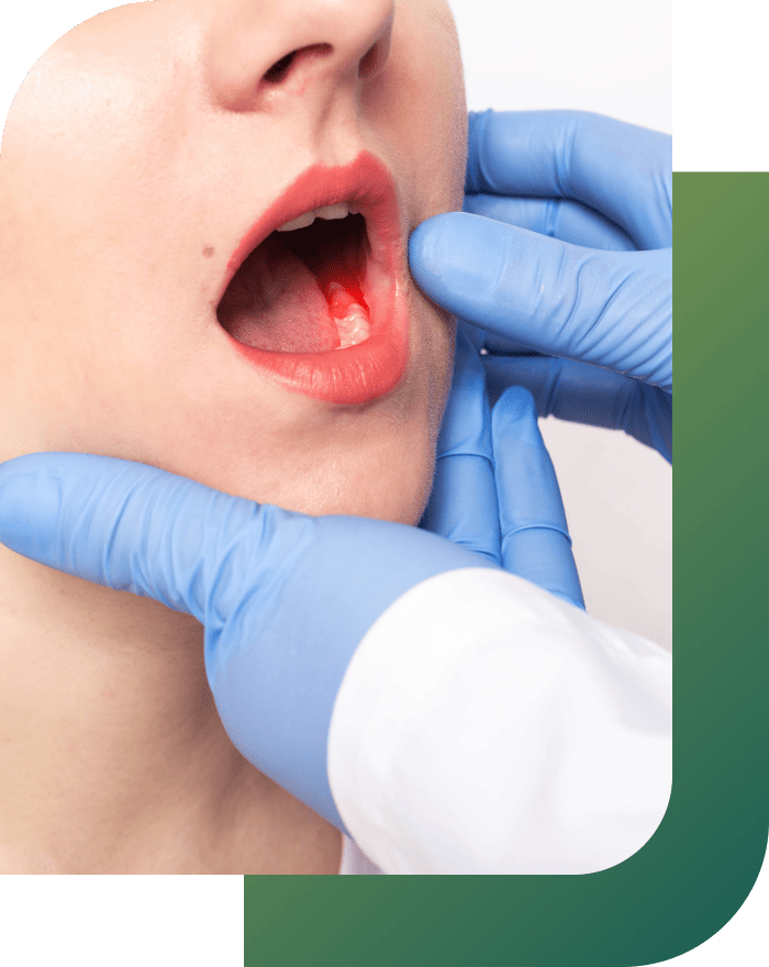 Dentist examining a patient's infected tooth, assessing the condition for treatment.