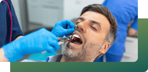 Dentist using forceps for a gentle tooth removal on a man, ensuring careful extraction without causing tissue damage.
