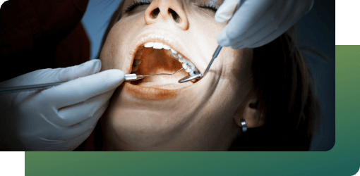 Professional performing abscess drainage on a patient using dental tools for dental abscess treatment.