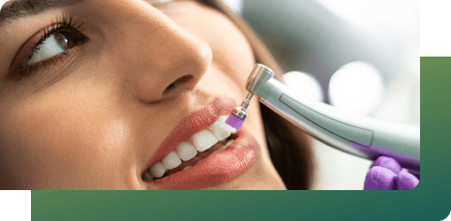 Dentist performing bite check and polishing on a patient's teeth with a dental tool after placing amalgam fillings.