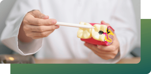 Dentist holding a dental model, explaining decay removal with cavity fillings.