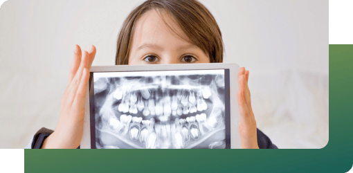 A young child holding a dental X-ray, used in pediatric dental care to check for cavities with low radiation exposure.