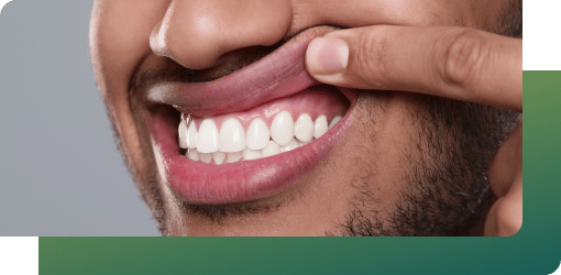 A man highlights his gum health, symbolizing general dental services and preventive care for maintaining strong gums.