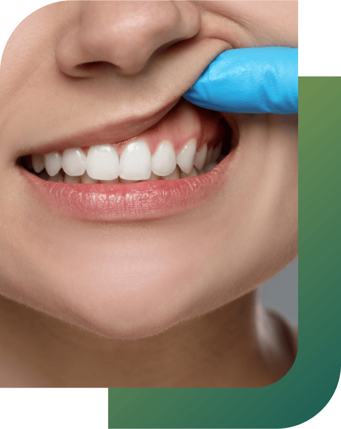 Person showing how to care for healthy gums.
