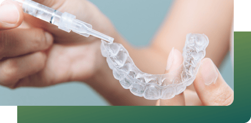 A technician holding a custom mouth guard and applying whitening gel with a syringe to safeguard teeth.