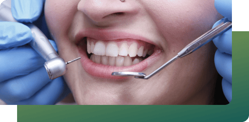 A close-up of a smiling patient undergoing a smile makeover, highlighting professional tools and bright white teeth.