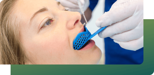 A dentist takes a dental impression for porcelain veneers, sends it to a lab, and provides temporary veneers in the meantime.