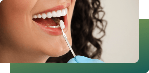Dental professional cleaning teeth with a dental instrument to prepare for porcelain veneers bonding with cement and light.