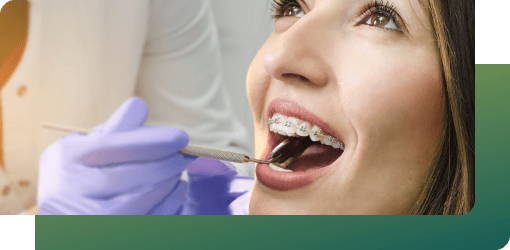 An adult woman with braces at an adult orthodontic check-up for aesthetic goals.