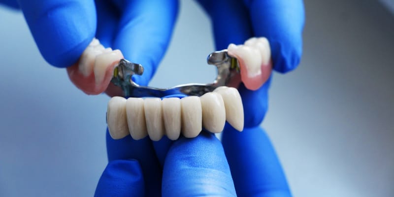 A dentist holding a dental bridge emphasizes the importance of proper oral care and maintenance.